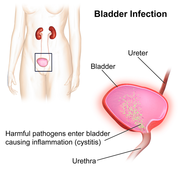 What Problems do Urologists Treat In Women?